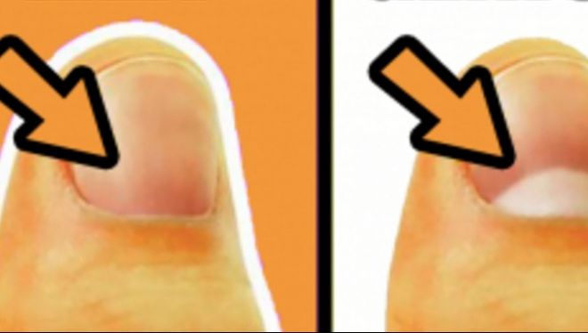 SEMILUNA de la baza unghiilor este foarte importantă. Iată ce reprezintă! Dacă dispare, e GRAV