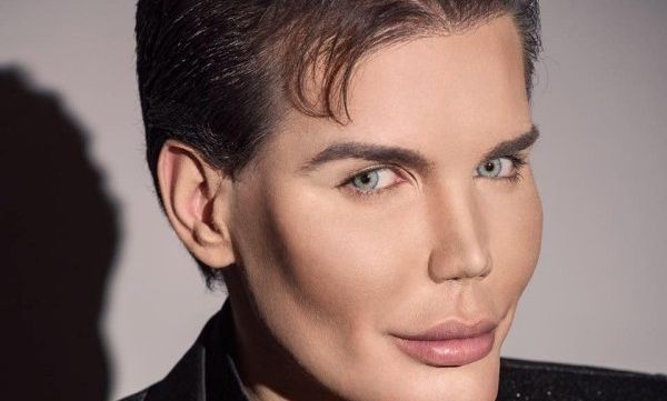 Ajunsese celebru când s-a operat ca să arate ca "Păpușa Ken". Veste ȘOC despre tânărul desfigurat