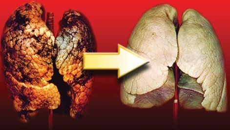 Opt alimente care curăţă plămânii. Iată cum poţi scăpa de toxine