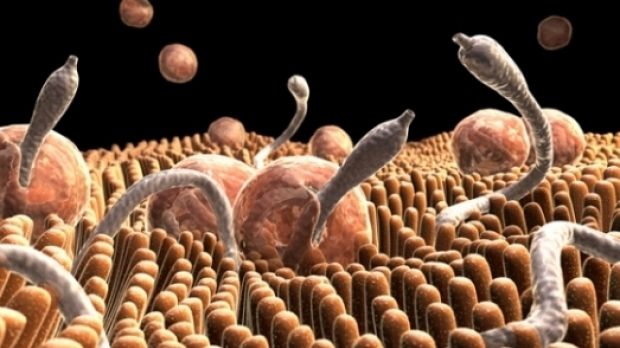 Multe persoane au paraziţi intestinali şi habar n-au. Iată care sunt primele simptome