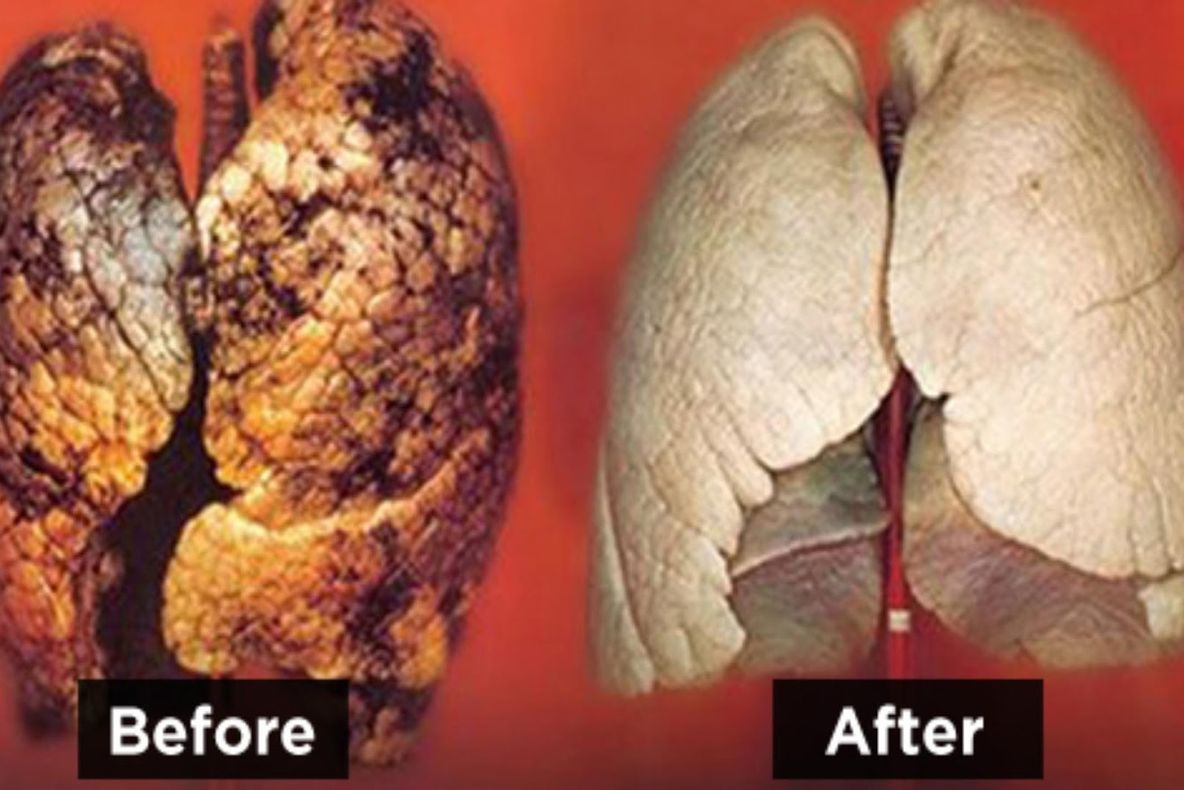 Orice fumător trebuie să consume acest aliment. Îți curăță plămânii de nicotină