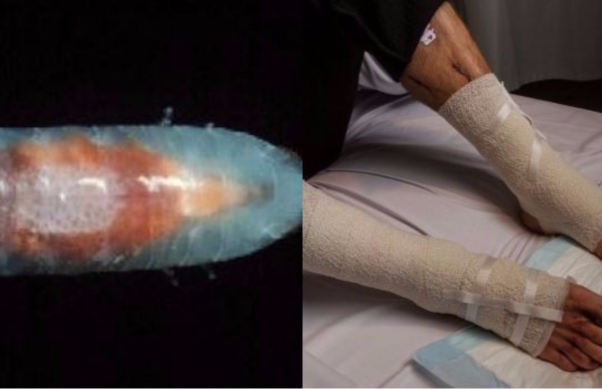 A intrat în mare și mii de viețuitoare minuscule misterioase au început să-i mănânce picioarele