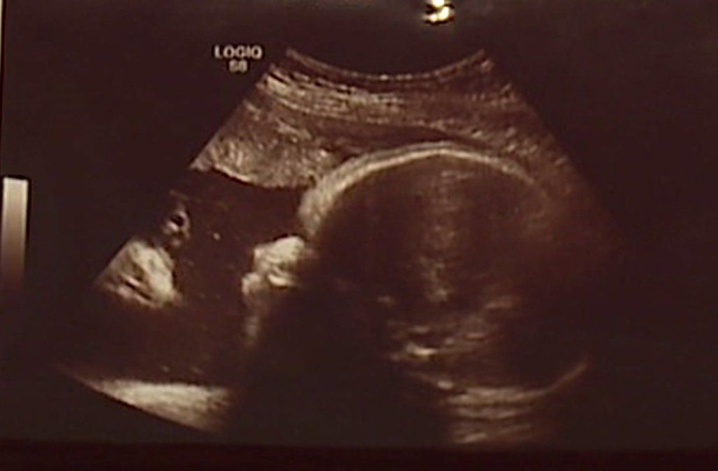 Doi părinţi au început să creadă în MIRACOLE. Ce semn uimitor au primit în ecografia bebeluşului!