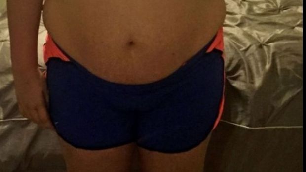 Credeau că fiica lor suferă de obezitate. Când medicul le-a spus ce avea, au fost ȘOCAȚI