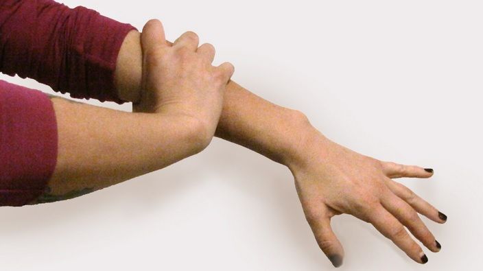 Ce probleme de sănătate anunță durerea la mâna stânga. Dacă apare brusc, mergi URGENT la medic!