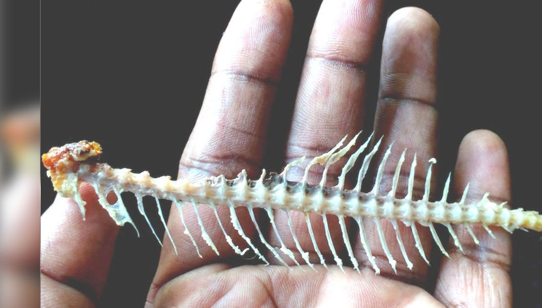 Ce trebuie să faci dacă te îneci cu un os de peşte. Cele mai eficiente metode. Foarte rapide 