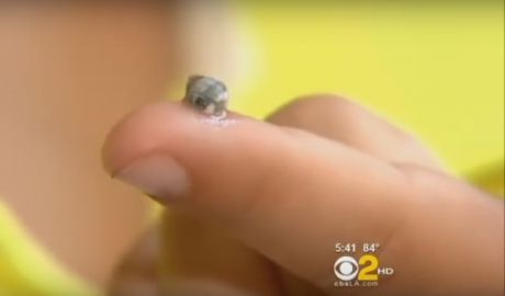 Doctorul i-a spus mamei să nu stoarcă buba copilului, dar n-a ascultat. Ce creatură a ieşit de acolo