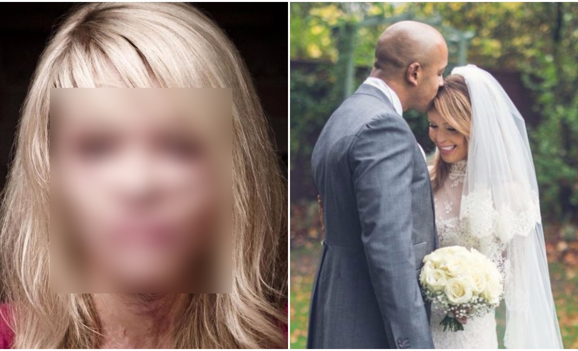 Iubitul i-a aruncat cu acid pe faţă. Cum a ajuns să arate acest top-model a întristat o ţară