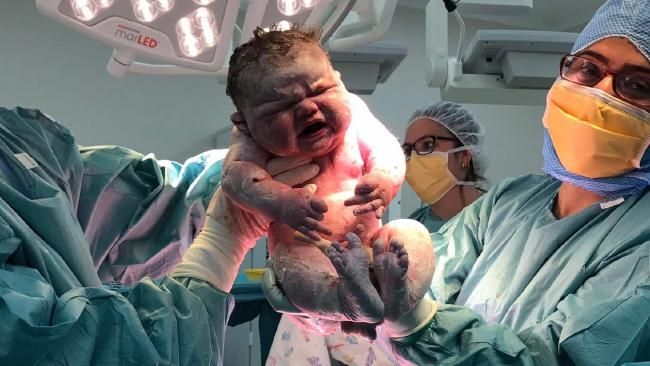 Bebeluşa care a BĂTUT toate RECORDURILE, încă de la naştere