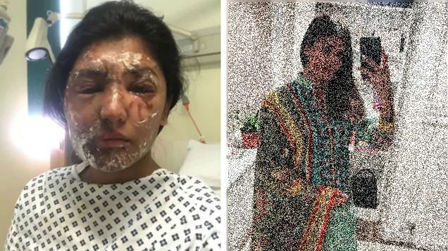 I-a distrus fața cu acid la doar 21 de ani. Azi și-a arătat iarăși chipul. Recuperarea e miraculoasă