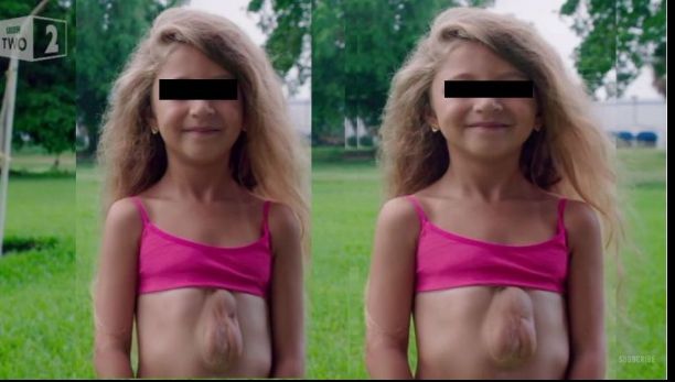 Îi bate inima în afara corpului! Cum a reușit să supraviețuiască