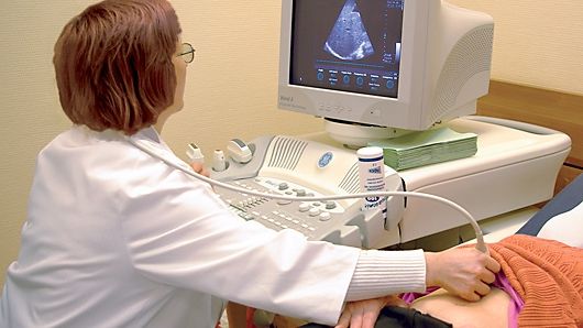 Simţea o durere în partea stângă şi s-a dus la medic. După ecografie a înlemnit: E un MONSTRU!