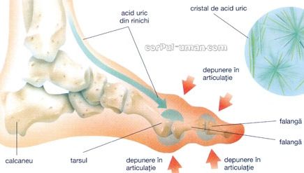 Boala consumatorilor de carne. Simptomele care trebuie să te alarmeze