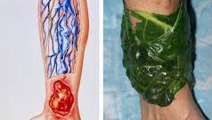 Uimitor! Iată ce efect terapeutic au foile de varză