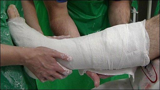 Un chirurg ortoped şi-a rupt piciorul chiar la intrarea în sala de operaţie