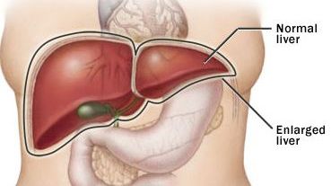 Alimentul de toamnă care are grijă de sănătatea ficatului