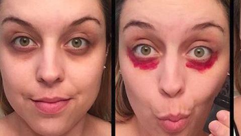 Şi-a aplicat ruj roşu sub ochi şi a scăpat de cearcăne. Vei încerca asta imediat!