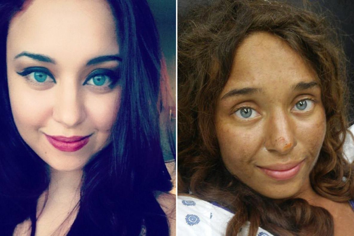 Povestea dramatică a fetei care a supravieţuit 25 de zile în pădure. Cum a reuşit? 