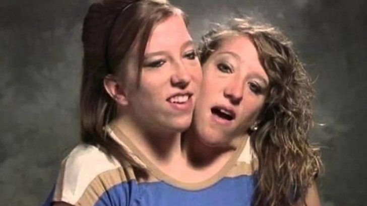 Cum arată viaţa intimă a siamezilor. După atâţia ani de întrebări, s-a aflat răspunsul - FOTO