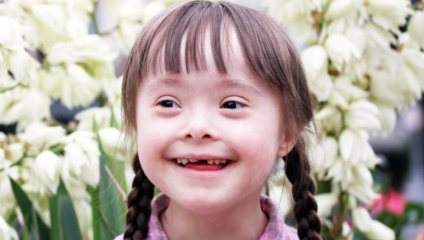 Islanda este prima ţară europeană care aproape a eradicat sindromul Down