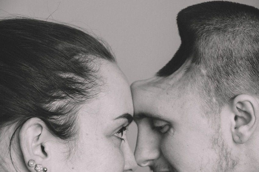 Era fericit, soţia lui aştepta un copil. A suferit un accident, trăieşte fără jumătate de cap