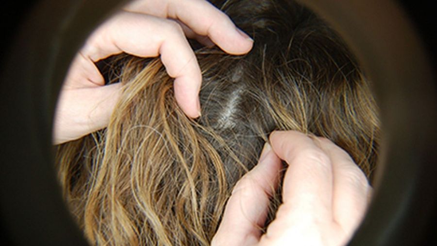  Sute de elevi, depistaţi cu păduchi