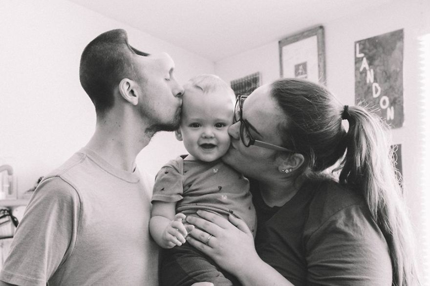 Povestea bărbatului care trăieşte fără un sfert de cap: Motivul şocant pentru care a ajuns aşa!