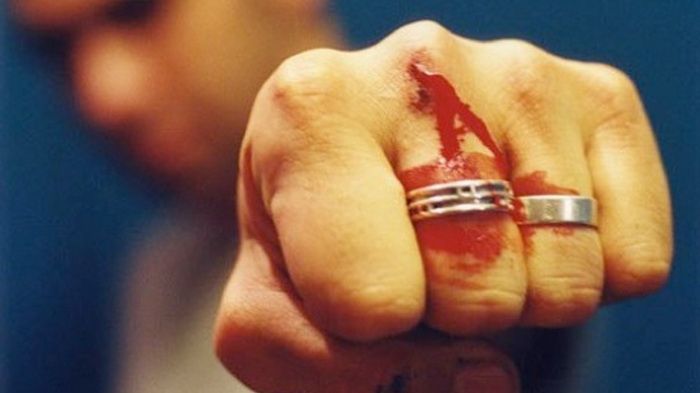 Un tată și-a făcut singur dreptate. Ce i-a făcut profesorului care i-a agresat fiica