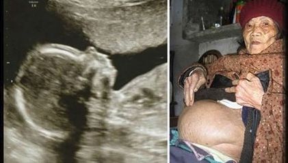 Cazul incredibil al femeii din China care a născut, după 60 de ani de sarcină