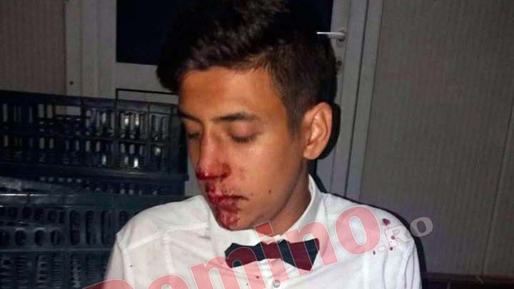 Mirele care a bătut un ospătar este POLIŢIST