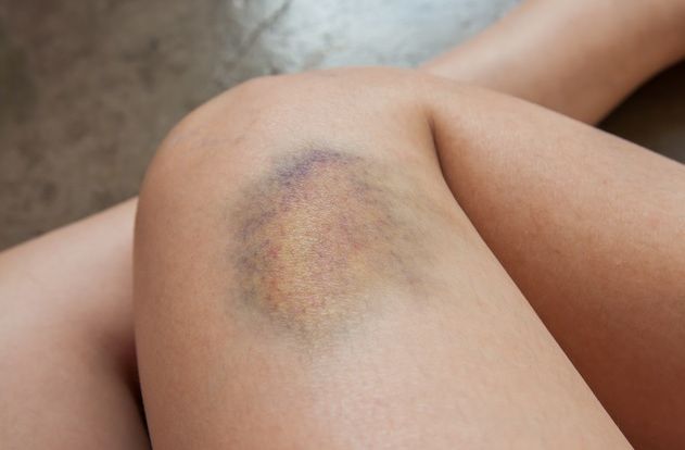 Simptome ale cancerului pe care femeile le ignoră cel mai des