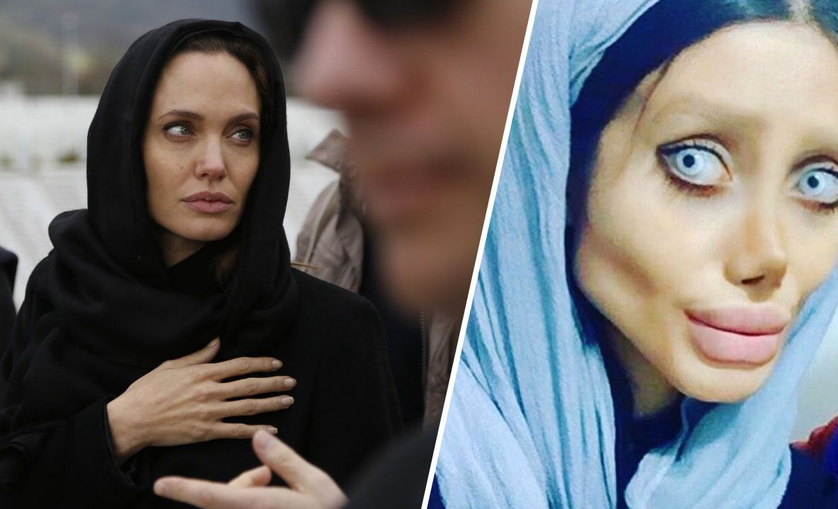 Adolescenta care a făcut 50 de operaţii estetice ca să arate ca Angelina Jolie. Rezultatul e teribil