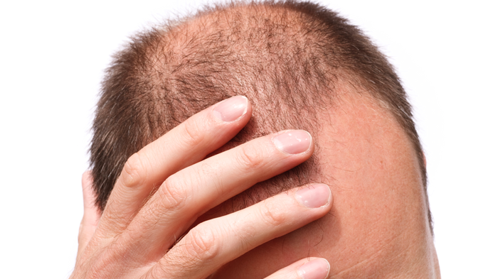 Multă lume nu ştie, însă ai nevoie de un singur ingredient ca să opreşti căderea părului