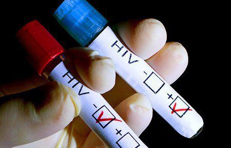 Propunere-bombă legată de testele HIV/SIDA