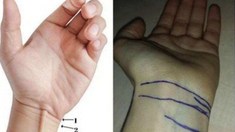 Interesant! Dacă ai aceste 3 linii la mana înseamnă că…