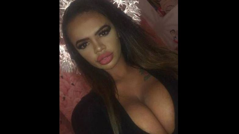 După operația estetică le-a zâmbit, iar ei s-au îngrozit. Apoi au văzut restul corpului..Dumnezeule!