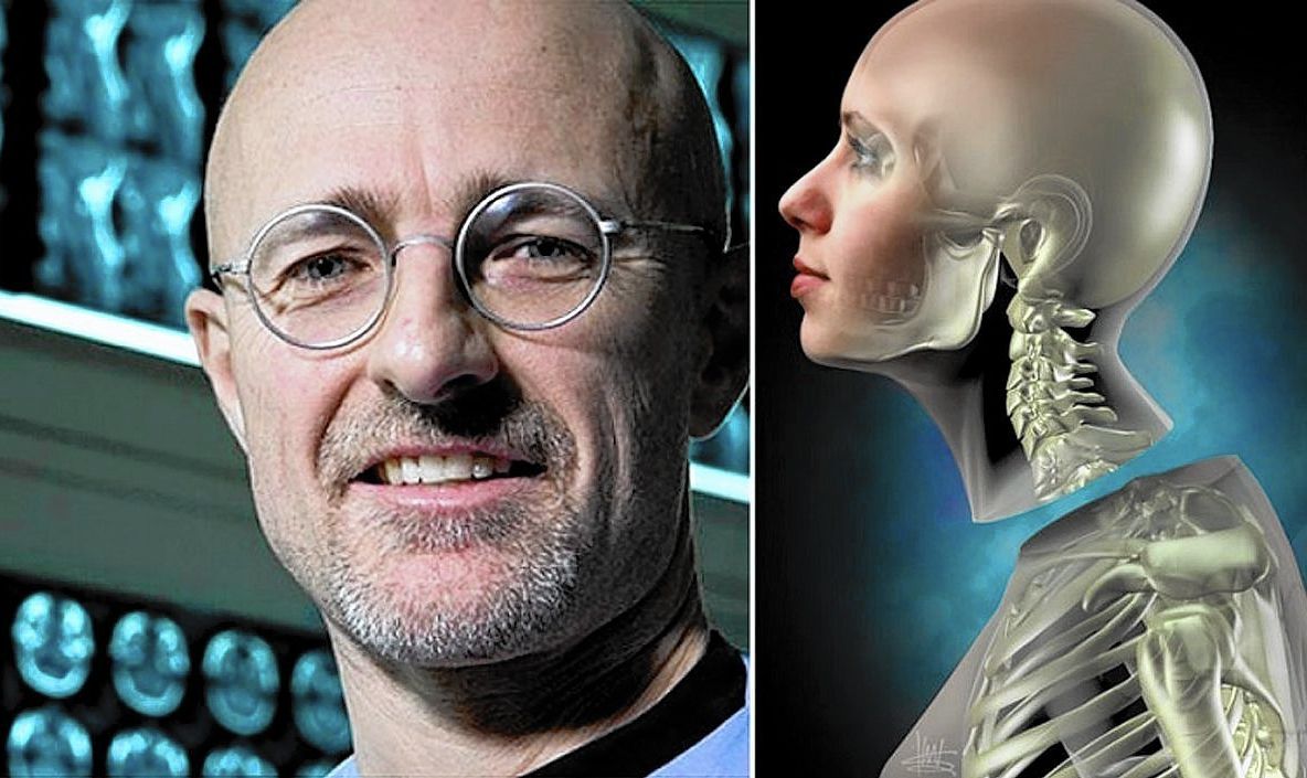 Controversatul neurochirurg care a promis primul transplant de cap uman, o nouă provocare