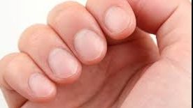 Ce afecțiuni indică unghiile fragile. Semnale pe care le transmite organismul și la care trebuie să fii atent