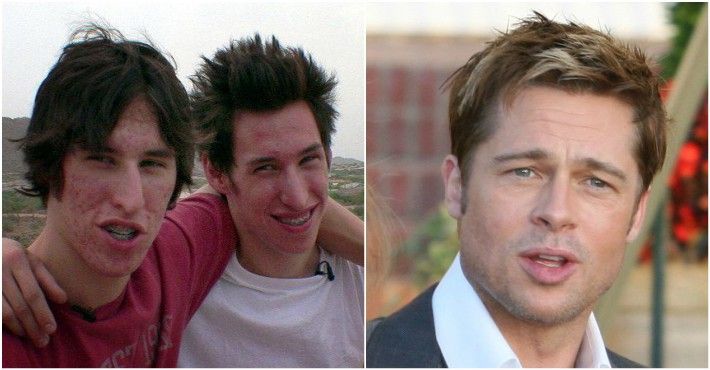 Gemenii care au cheltuit 20.000 de dolari pe operaţii estetice ca să arate ca Brad Pitt
