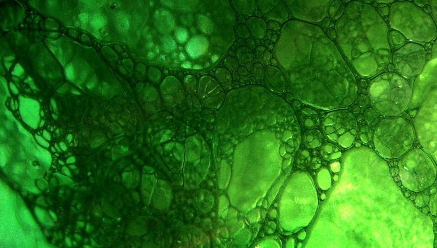 Ce este, de fapt, "sângele verde". Medicii au făcut un anunţ şocant!