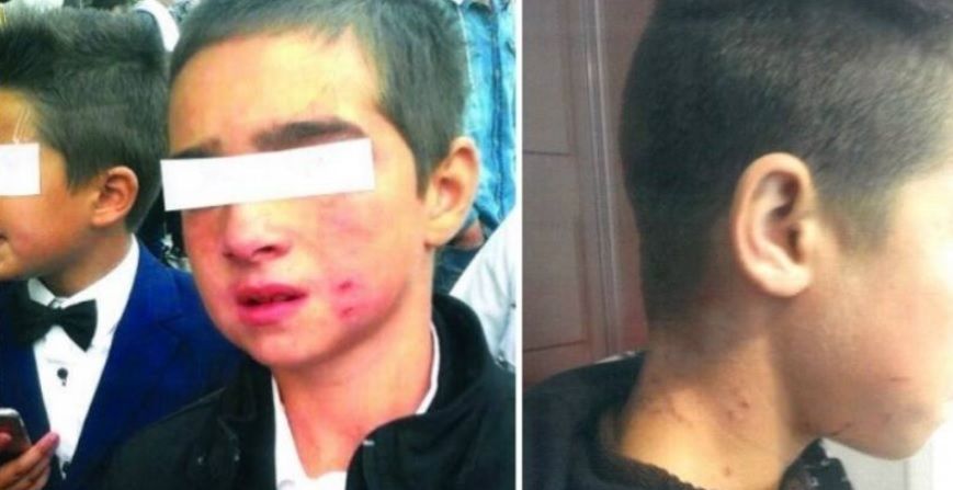 Ce se întâmplă la o şcoală din România. Copiii, bătuţi şi zgâriaţi de directoare - FOTO