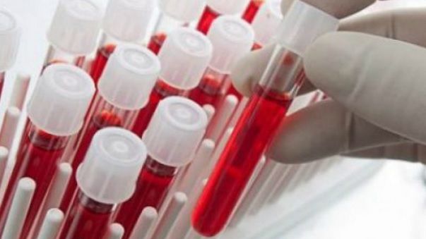 Ce boli poate ascunde hemoglobina scăzută?