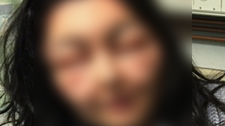 A folosit un produs foarte des utilizat de femei, dar a rămas desfigurată: Arăt ca un monstru