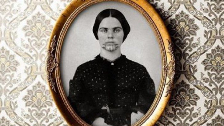 Povestea şocantă din spatele acestei imagini. Cine este tânăra cu semnele misterioase pe faţă?