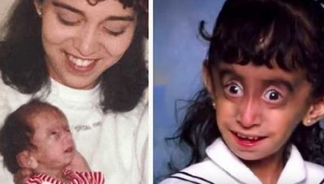 I s-a spus că e un monstru care trebuie ucis cu foc! După 25 de ani, tânăra a şocat cu apariţia sa!