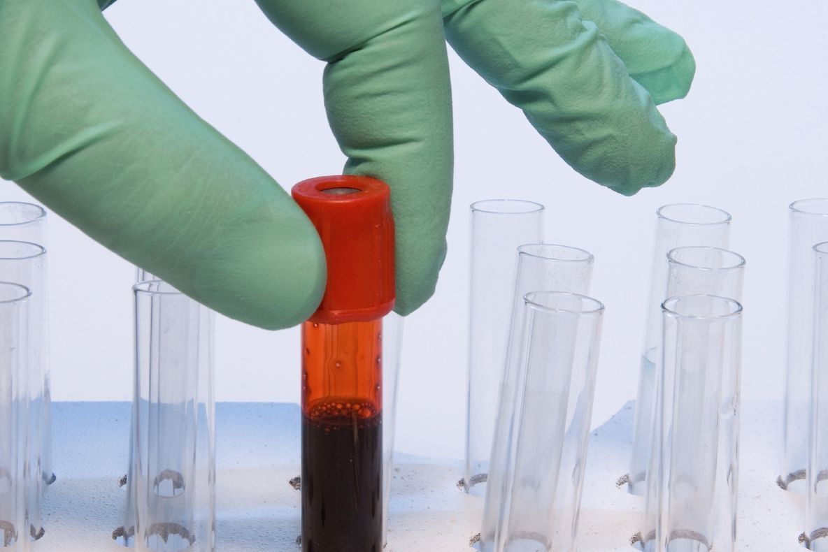 Criza de imunoglobulină continuă. Medic: "Imunoglobulina trimisă de minister e un ALT fel"