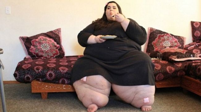 Cu un an în urmă medicul refuzase s-o opereze pe fată. Revăzând-o mai apoi, nu i-a venit să creadă!