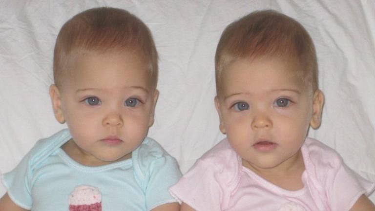 Fetiţele care, la 7 ani, sunt considerate CELE MAI FRUMOASE gemene identice din lume. Cum arată