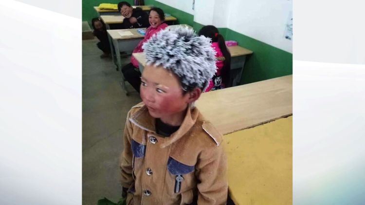 Povestea impresionată a băiatului cu părul de gheaţă