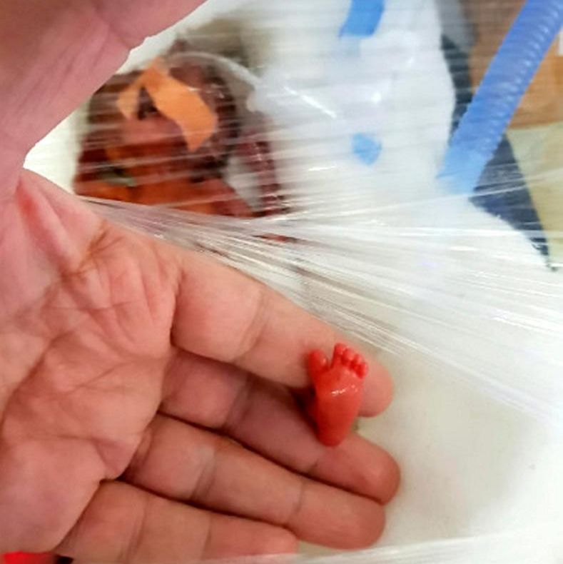 Miracolul acestei familii. Bebelușul lor cântărea la naștere cât o cutie de ciocolată și acum ...